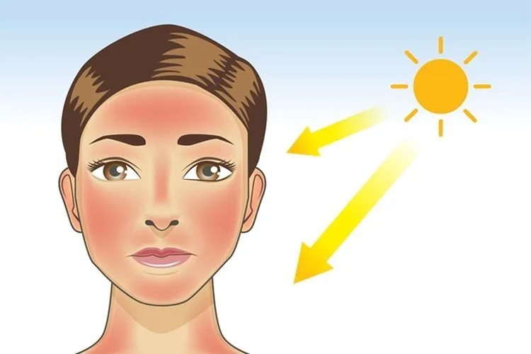 Cháy nắng là gì? Khi làn da "biểu tình" dưới ánh mặt trời
