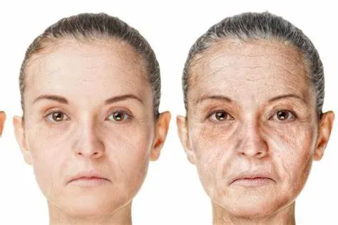 Lão hóa da là gì? Những dấu hiệu và nguyên nhân chính
