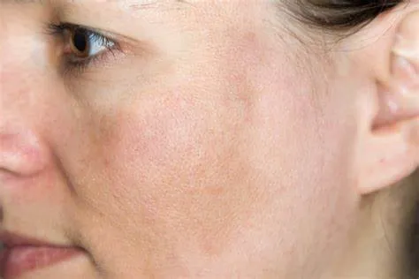 Làn da kém tươi sáng: Những nguyên nhân khiến da xỉn màu, không đều màu