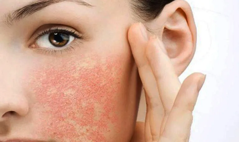 Những dấu hiệu "quá liều" tẩy tế bào chết và cách khắc phục