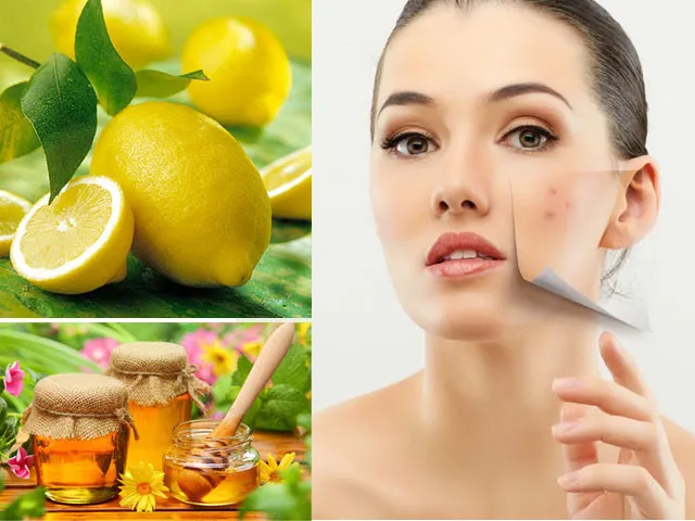 Xây dựng quy trình chăm sóc da mụn trứng cá hiệu quả với mỹ phẩm thiên nhiên