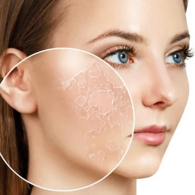 Làn da kém mịn màng: Những yếu tố khiến da trở nên sần sùi