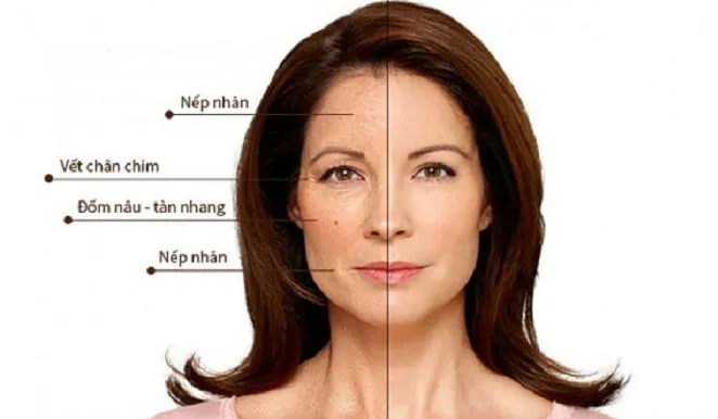 Những lưu ý quan trọng khi chăm sóc da tuổi trung niên