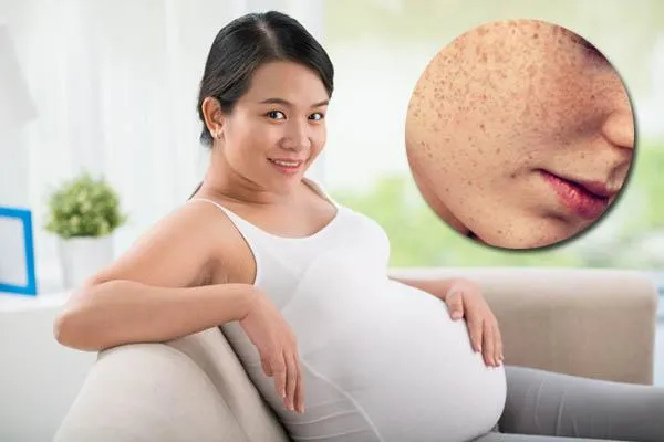 Làn da khi mang thai: Những thay đổi thường gặp và lý do cần cẩn trọng khi chọn mỹ phẩm