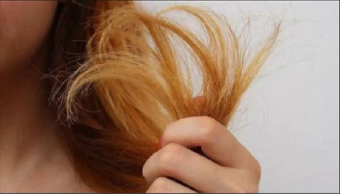 Tóc khô xơ, thiếu mềm mại: Nguyên nhân và biểu hiện